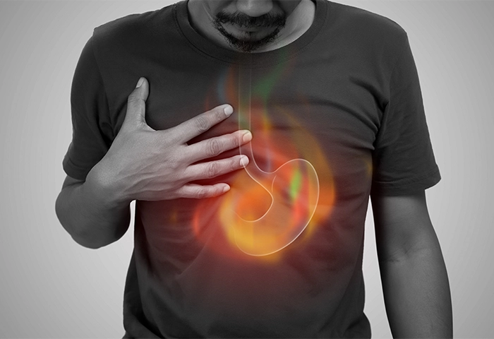 Signs Your Heartburn May Be More Than Just Acid Reflux