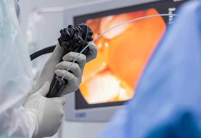 Understanding ERCP: A Life-Saving Procedure for Bile Duct Disorders